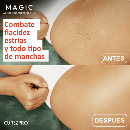Aceite Corporal Original Magic™